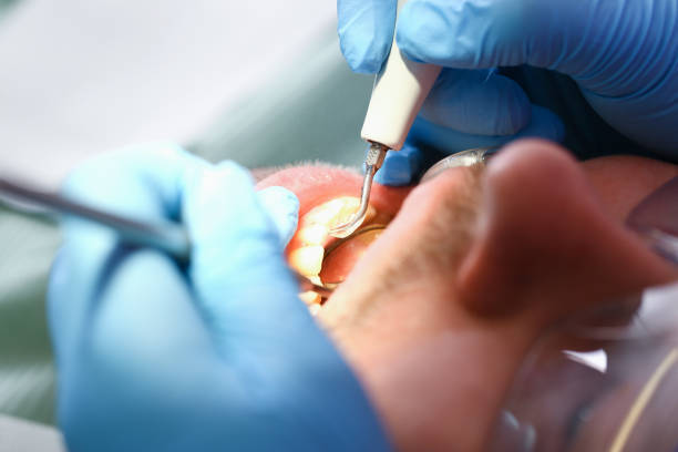 Best Emergency Dentist for Knocked-Out Tooth in Lake Mohegan, NY